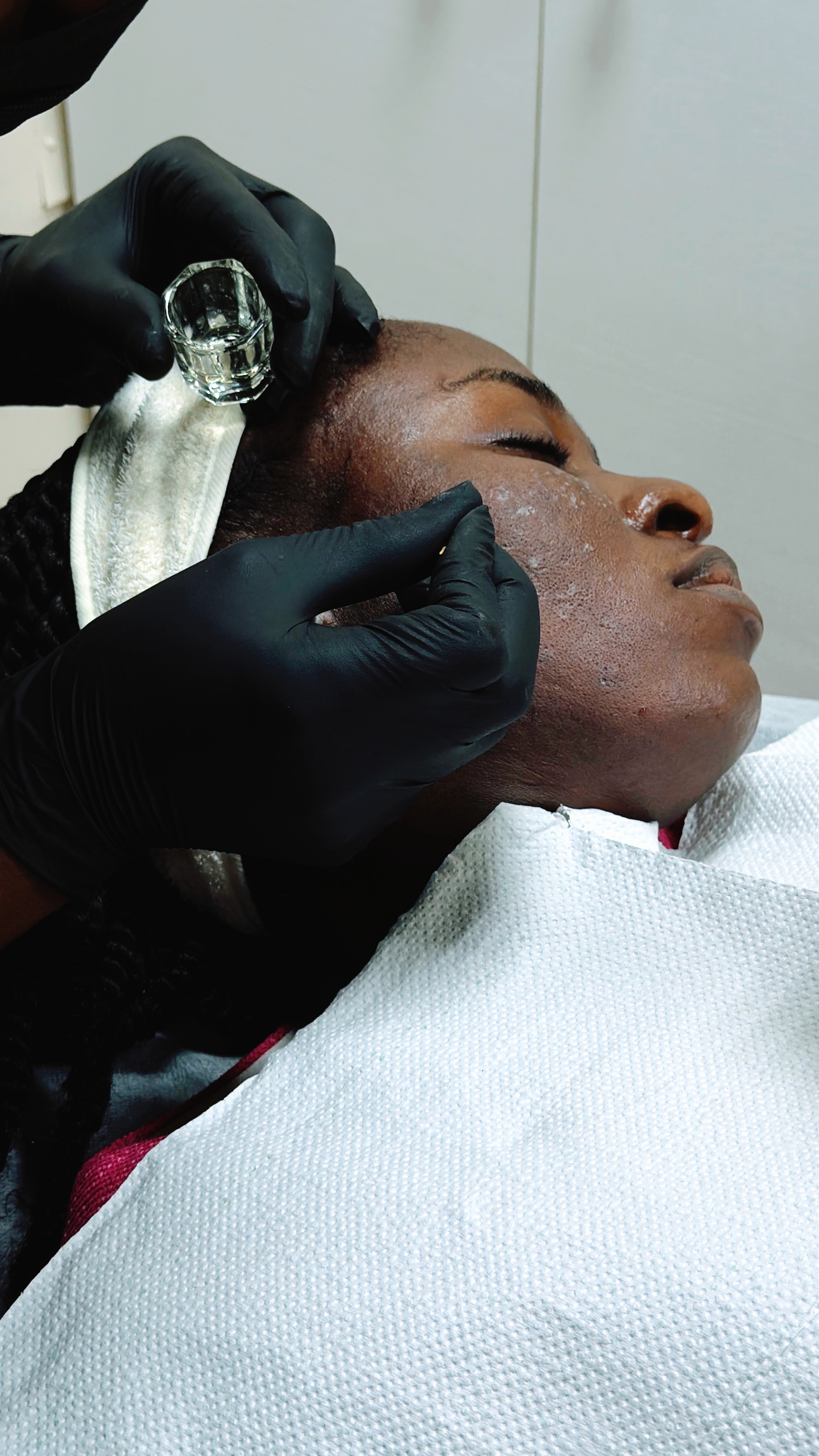 Facial skin treatment.